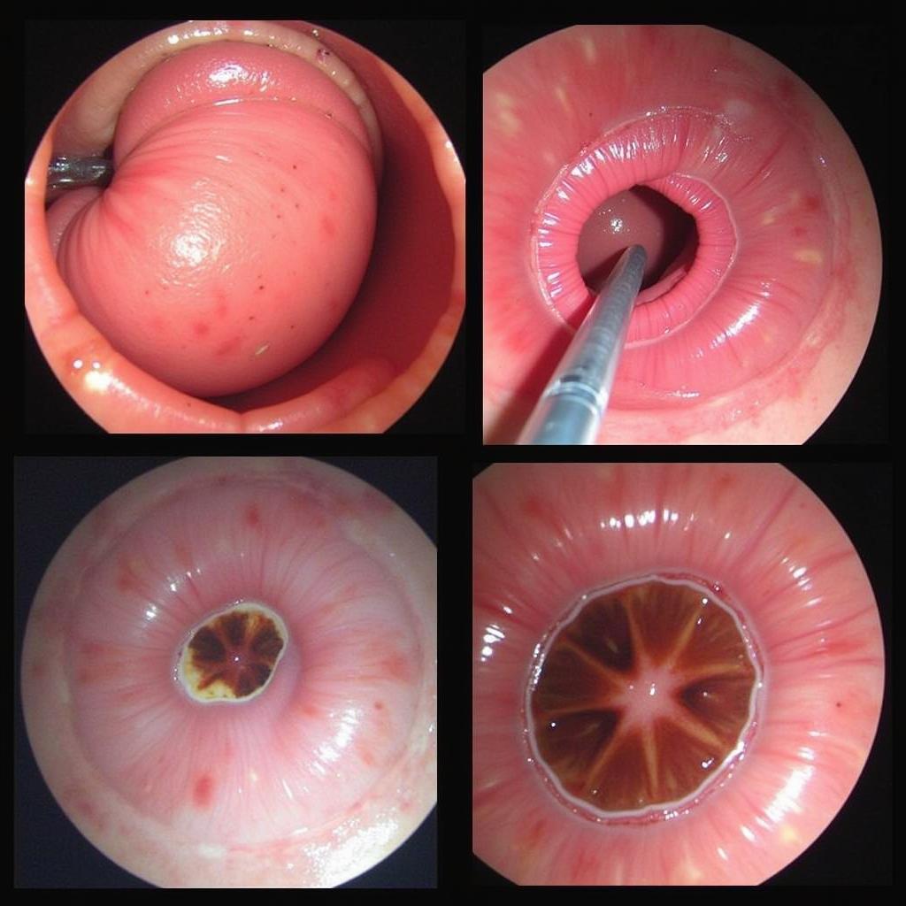 Endoscopic View of a Horse's Stomach