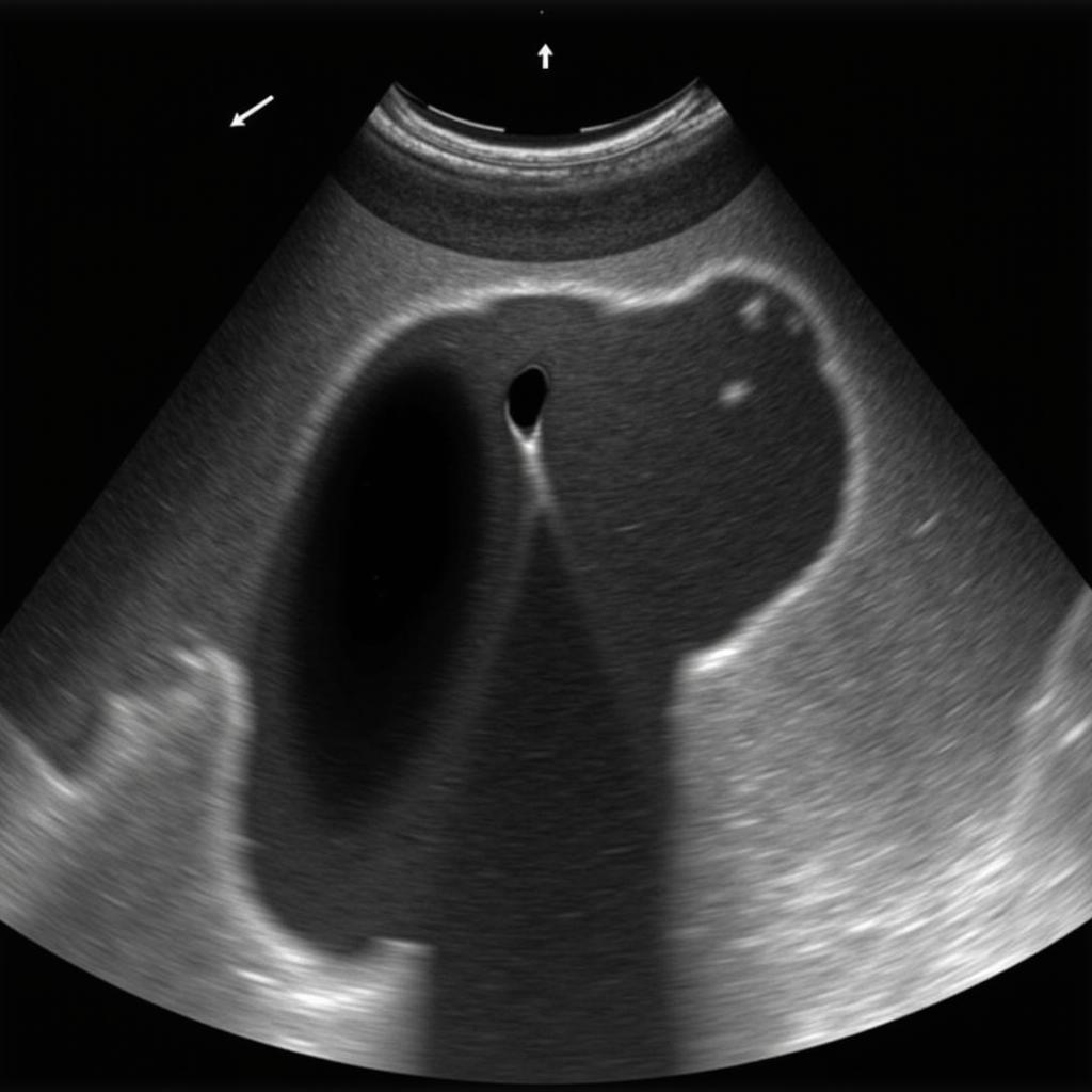 Ultrasound Image of a Hind Leg Tendon Injury