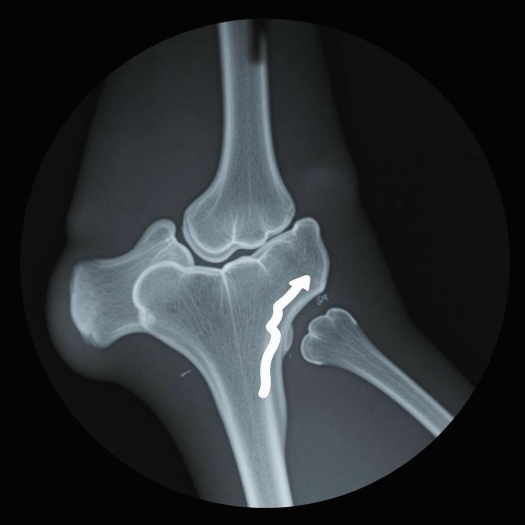 Horse Rib Fracture X-ray